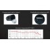 AudioDesign *MDT-603 In Ear profissional